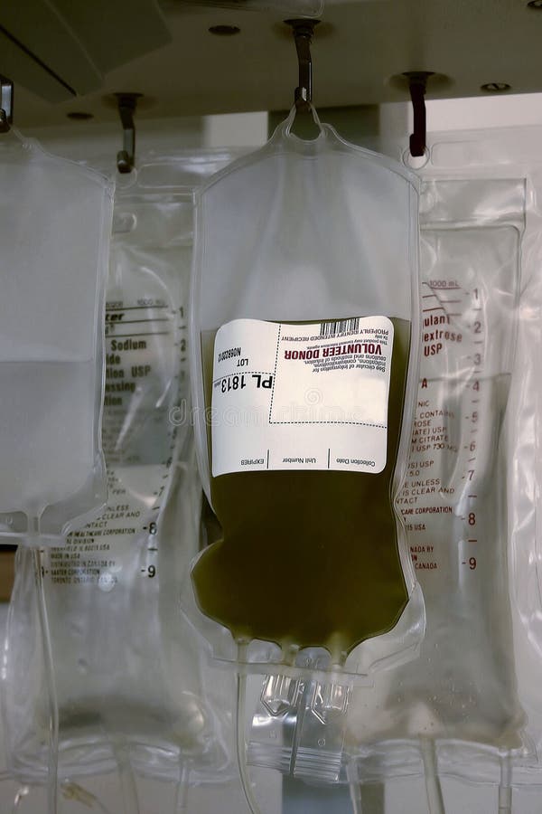 Hanging Bag Of Platelets From Blood Donation Stock Photo