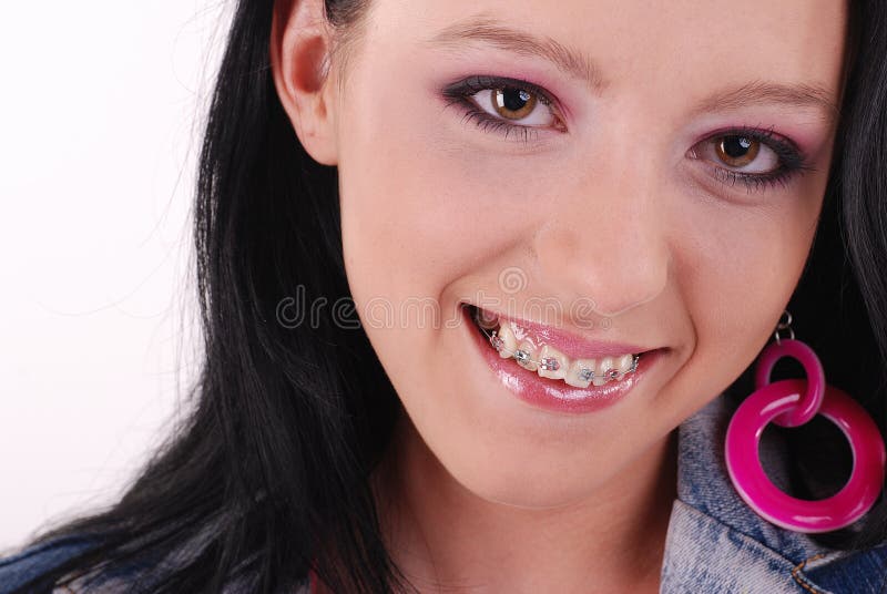 Teens With Braces Porn