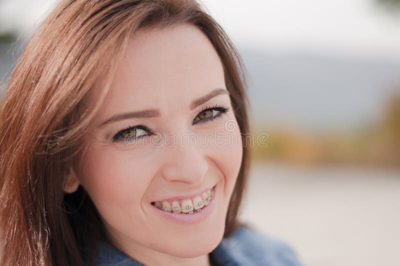 Smiling brunette female teen with mouth in wide smile. Teen wears braces. Whole face visible. Blurry backgorund. Smiling brunette female teen with mouth in wide smile. Teen wears braces. Whole face visible. Blurry backgorund