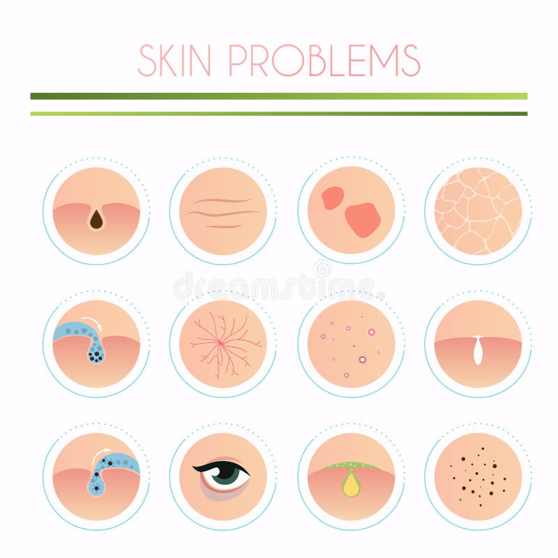 Hautproblemlösung, Hausmittel Skincare und Dermatologie stock abbildung Hautproblemlösung, Hausmittel Skincare und Dermatologie stock abbildung