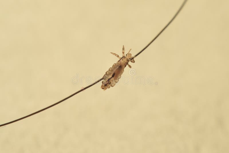 Insect Lice Crept on a Hair, Isolated on White Background. Stock Photo - Image of lice, insect: 216076002 Insect Lice Crept on a Hair, Isolated on White Background. Stock Photo - Image of lice, insect: 216076002