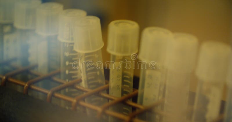 Health Care Clinic Laboratory - medical tube in mixing machine in laboratory