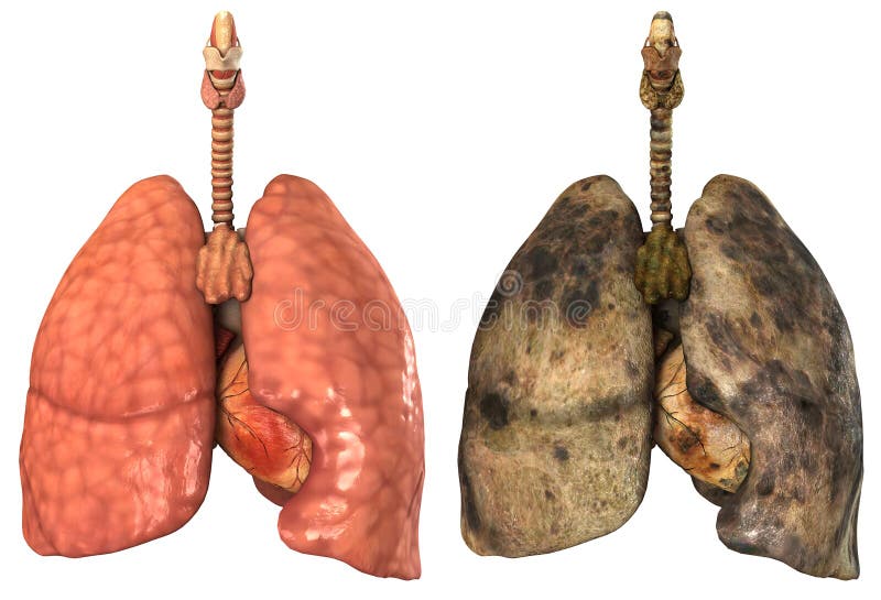 Pulmones de un fumador saludable pulmones en blanco.