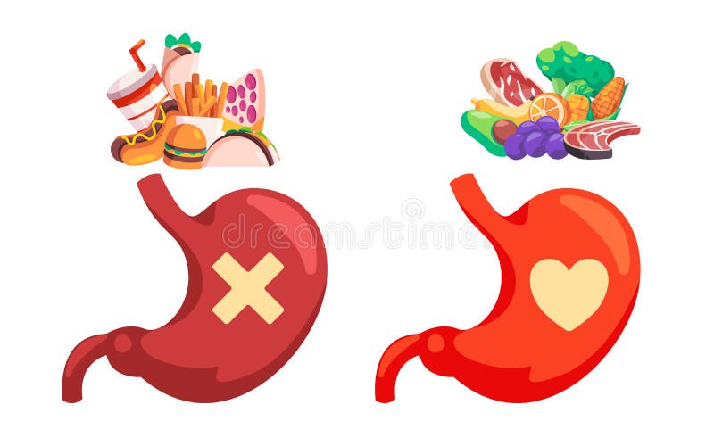 https://thumbs.dreamstime.com/b/healthy-vs-unhealthy-food-restricted-diet-choice-good-stomach-digestive-organ-vector-healthy-vs-unhealthy-food-restricted-251742595.jpg