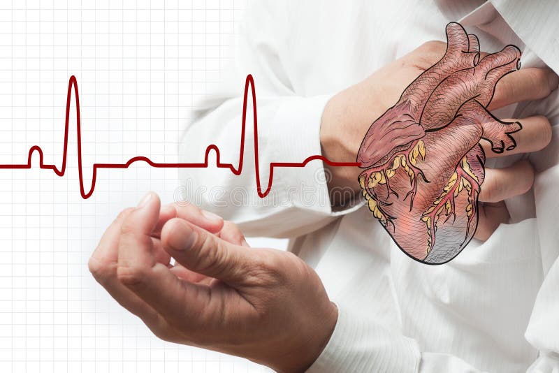 Heart attack and heart beats cardiogram royalty free stock photos