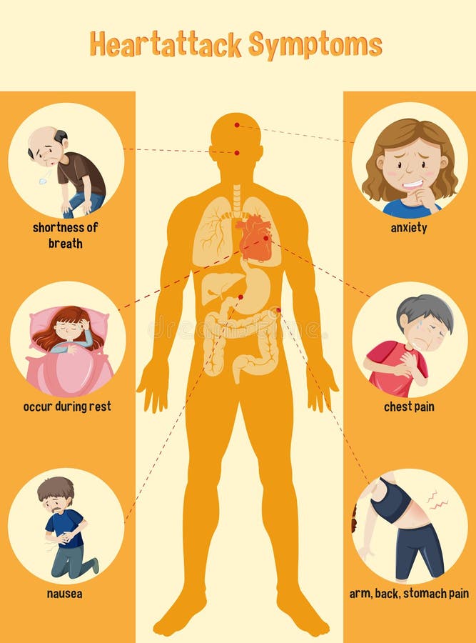 Heart Attack Symptoms Information Infographic Stock Vector ...