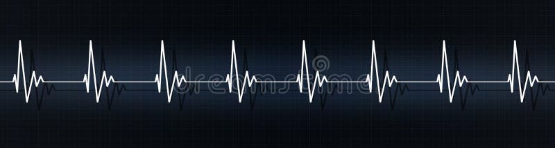 Heart beats on ecg