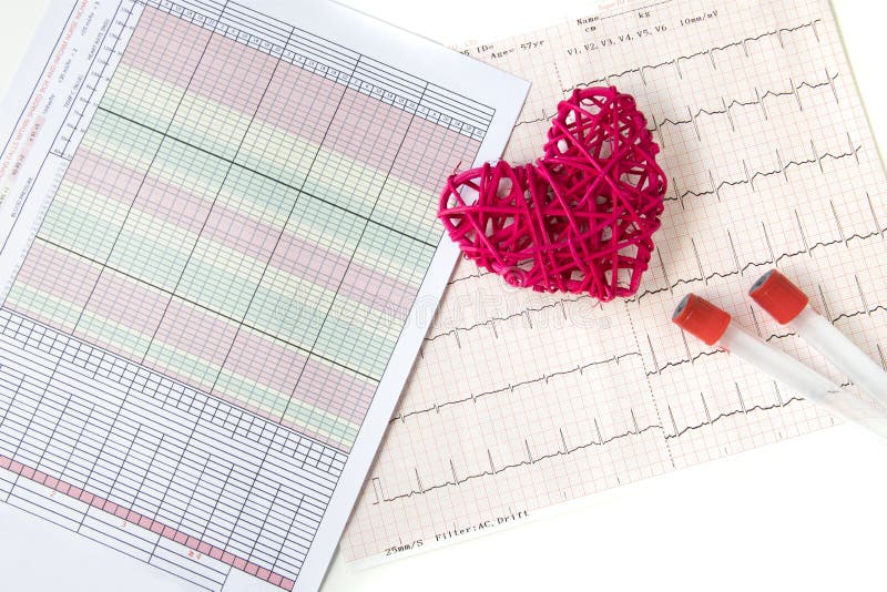 A red ratten heart, an electrocardiogram recording and a patient vital signs sheet with early warning signs. Healthy heart and quality care concept, technology, good, data, tool, frequency, clinical, exam, list, disease, equipment, examination, reporting, diagnostic, instrument, rate, sinus, rhythm, normal, ekg, cardiac, medical, life, paper, analysis, graph, wave, hospital, medicine, monitor, heartbeat, ecg, test, diagnosis, cardiology, background, pulse, chart, tubes. A red ratten heart, an electrocardiogram recording and a patient vital signs sheet with early warning signs. Healthy heart and quality care concept, technology, good, data, tool, frequency, clinical, exam, list, disease, equipment, examination, reporting, diagnostic, instrument, rate, sinus, rhythm, normal, ekg, cardiac, medical, life, paper, analysis, graph, wave, hospital, medicine, monitor, heartbeat, ecg, test, diagnosis, cardiology, background, pulse, chart, tubes