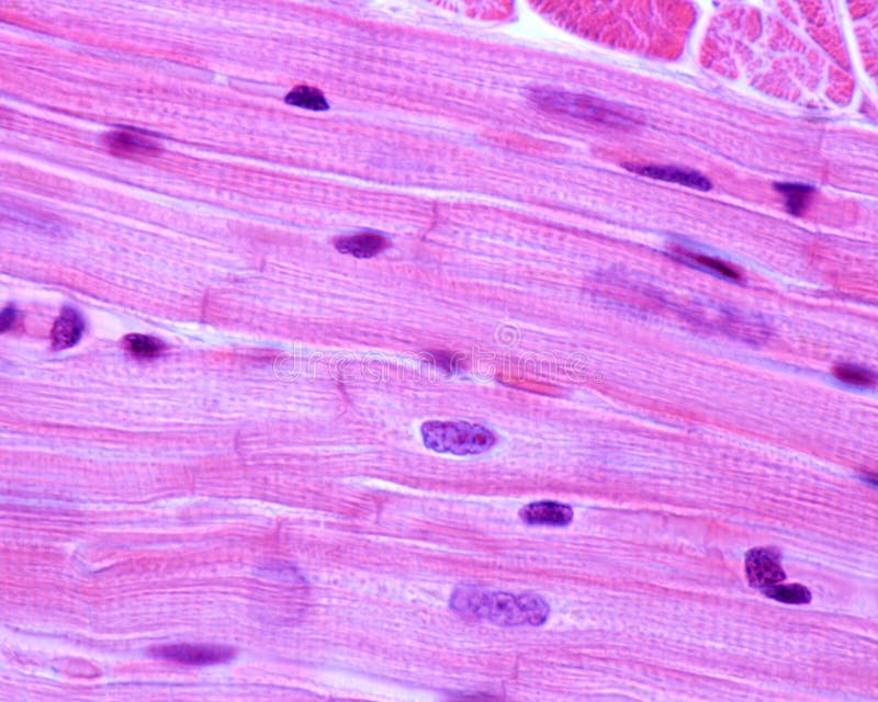 cardiac muscle striations