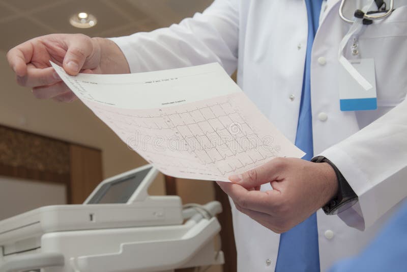 A doctors hand are holding a graph with an unconfirmed diagnosis of normal heart rate. A doctors hand are holding a graph with an unconfirmed diagnosis of normal heart rate.