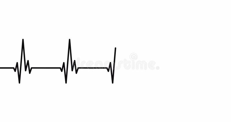 Heartbeat Line Animation. Heart Rate, Heart Rate or Cardiogram Concept.  ECG. Alfa Chanel. 4K Stock Illustration - Illustration of  electrocardiogram, diagnosis: 229024801