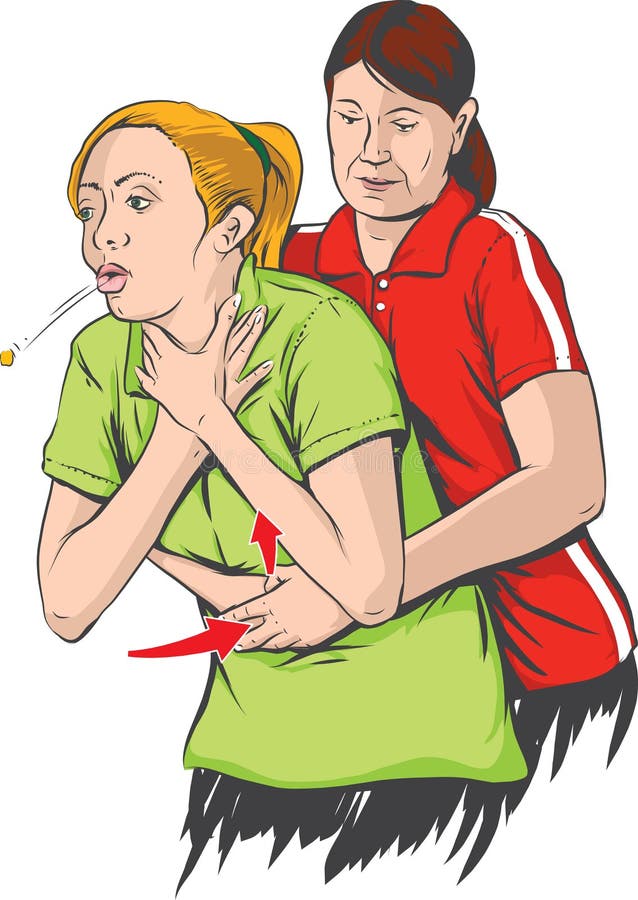 heimlich-maneuver-vector-illustration-performing-46971897.jpg