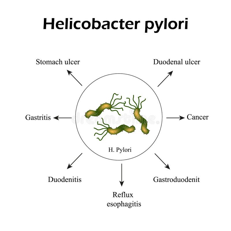 Behandlung Von Helicobacter-Pf?rtnern Medikationen Antiacida ...