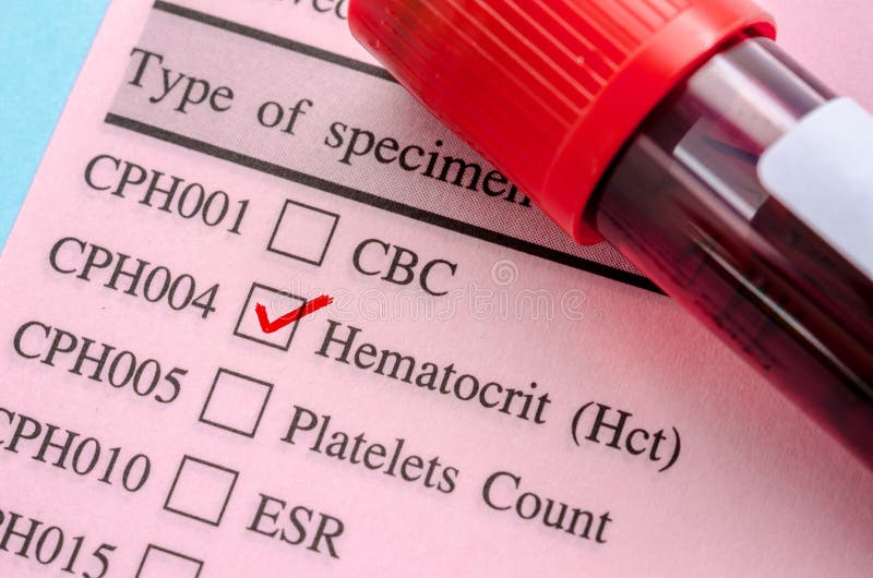 Hematocrit test blood. stock photo. Image of microbiology - 58680274