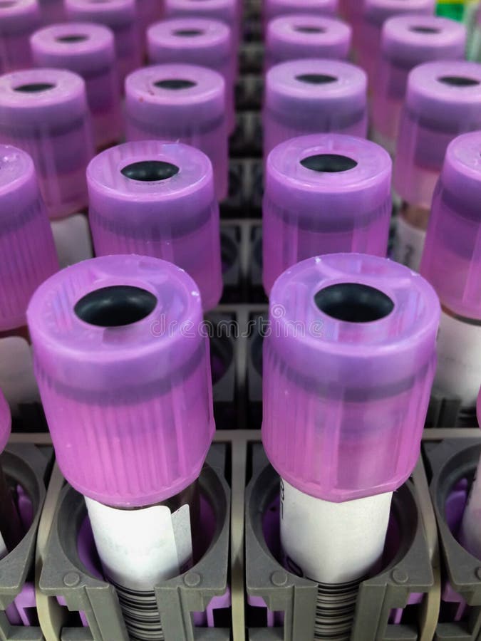 Hematology samples royalty free stock photography