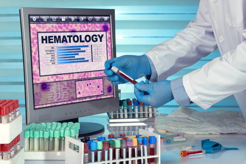 hematology-test-technician-in-hematology-lab-testing-blood-sample-in-computer-with-results