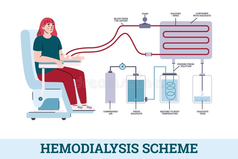 Dialysis Stock Illustrations – 3,353 Dialysis Stock Illustrations, Vectors  & Clipart - Dreamstime