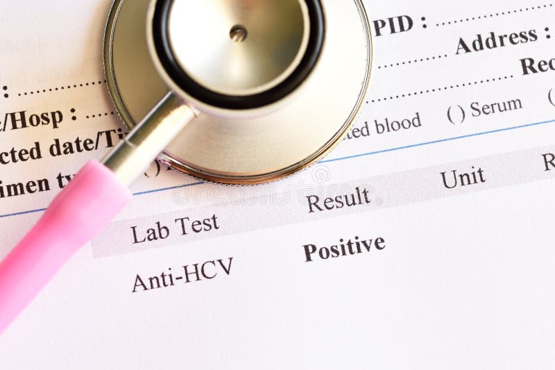 Hepatitis C virus positive test result stock photos