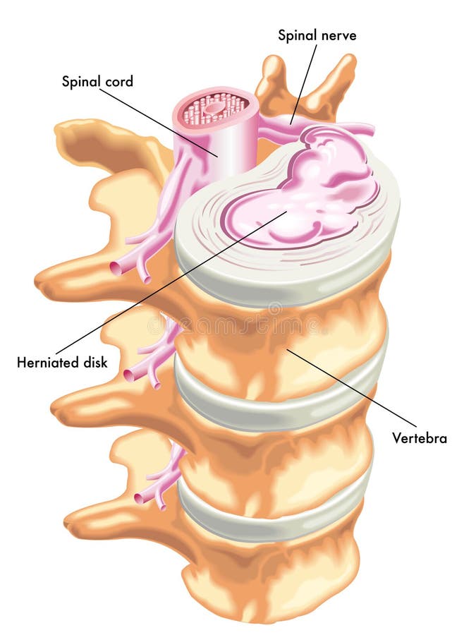 Medico illustrazioni da effetti da disco.