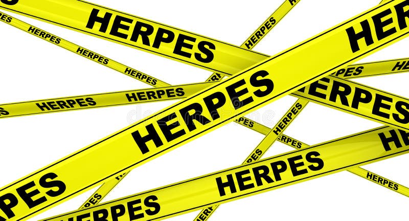 HERPES Gul varningsband vektor illustrationer