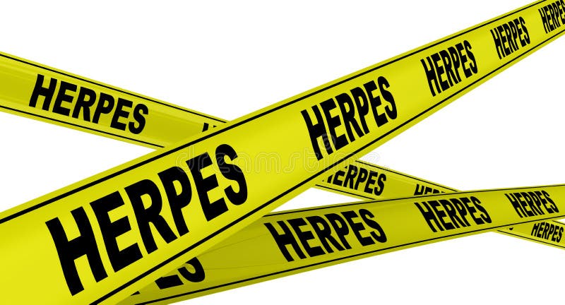 HERPES Gul varningsband stock illustrationer