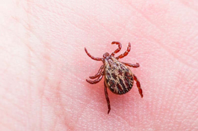 Hersenontstekingsvirus of Lyme Ziekte Besmet Tick Arachnid Insect op Huid