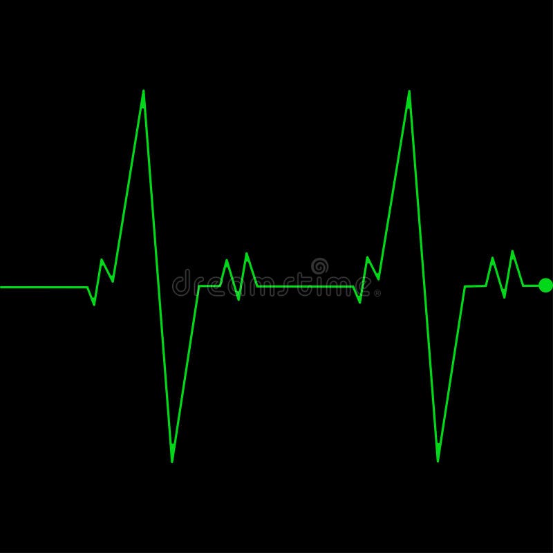 Herz Überwachungsanlage lokalisiert auf schwarzem Hintergrund Herzimpuls, Signal Herzschlag, Elektrokardiogrammlinie Kardiologie stock abbildung