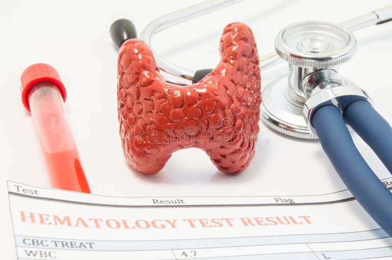 Het anatomische model van schildklier, stethoscoop en bloedonderzoekresultaten is op artsenlijst Concept voor de diagnose of het royalty-vrije stock foto Het anatomische model van schildklier, stethoscoop en bloedonderzoekresultaten is op artsenlijst Concept voor de diagnose of het royalty-vrije stock foto