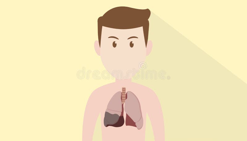 Het gezicht van het menselijk lichaamsbeeldverhaal met longontstekings zieke zieke long stock illustratie Het gezicht van het menselijk lichaamsbeeldverhaal met longontstekings zieke zieke long stock illustratie