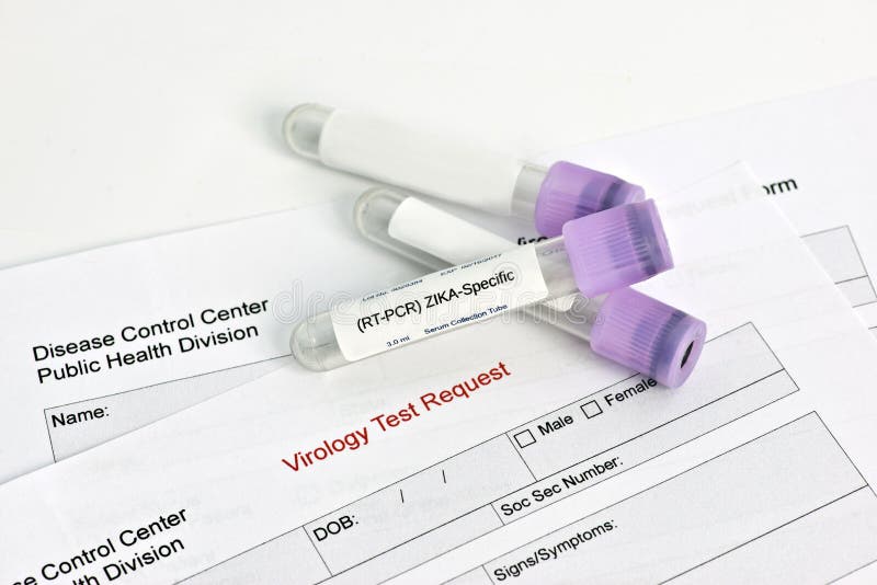 Het Laboratoriumtest van het Zikavirus stock foto Het Laboratoriumtest van het Zikavirus stock foto