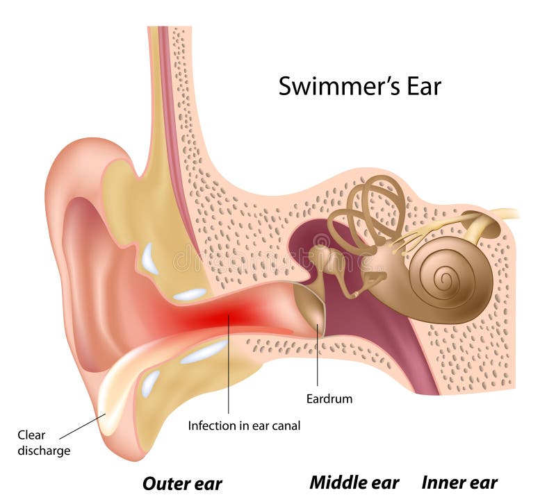 Het oor van de zwemmer
