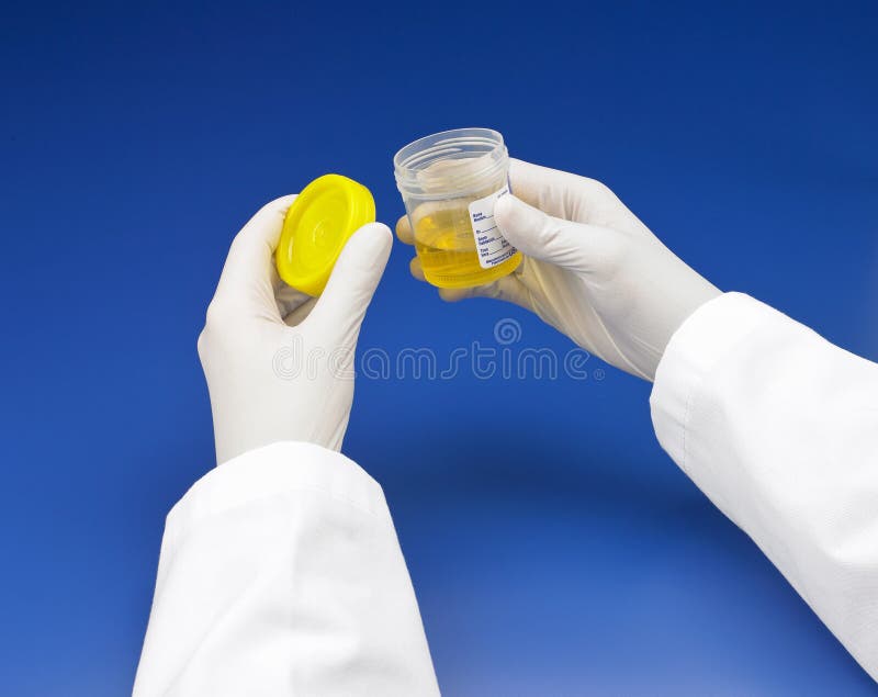 Het Specimencontainer Van De Urine Stock Afbeelding Image of geel
