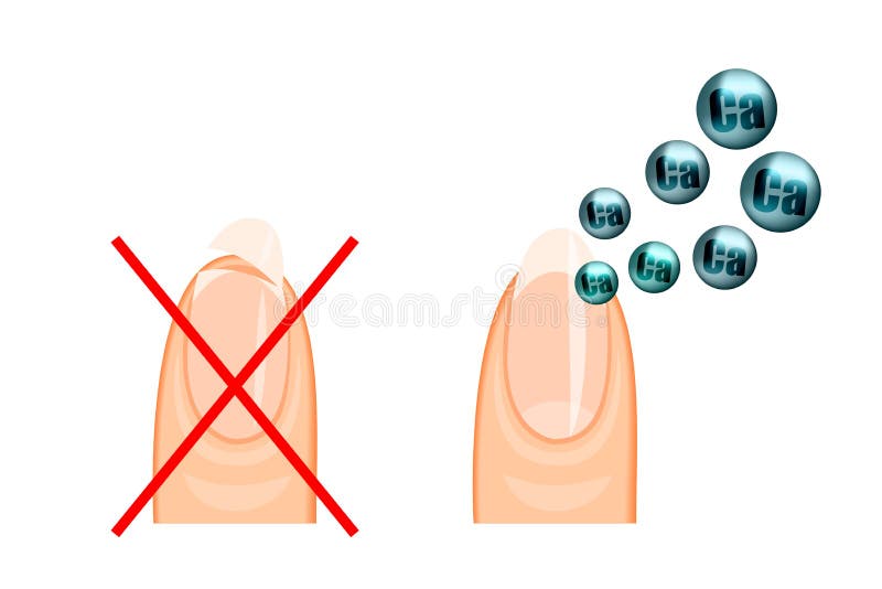 Illustration of healthy and broken nail and the molecules of calcium. Illustration of healthy and broken nail and the molecules of calcium