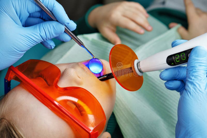 Het vullen van melktanden Tand kliniek royalty-vrije stock afbeeldingen Het vullen van melktanden Tand kliniek royalty-vrije stock afbeeldingen
