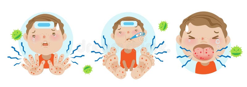 HFMD children infected. hand foot and mouth disease.Cartoon illustration