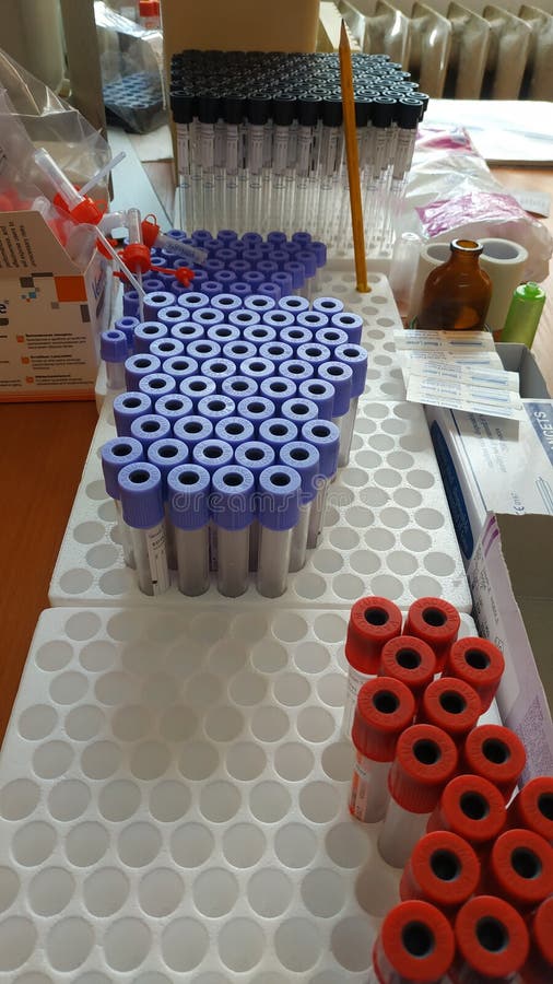 High Angle Vertical Shot of Blood Test Containers in the Laboratory