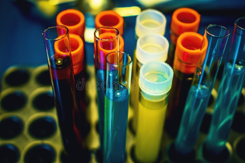 High-tech die laboratoriummateriaal in de bemestingsprocédé Bemesting in vitro van het de procedurelaboratorium van de eiherwinni royalty-vrije stock foto's