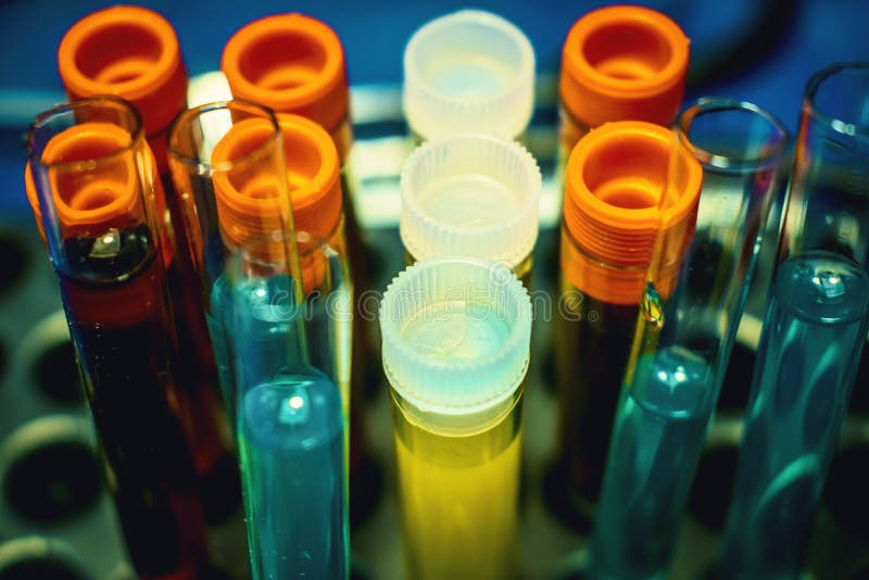 High-tech die laboratoriummateriaal in de bemestingsprocédé Bemesting in vitro van het de procedurelaboratorium van de eiherwinni stock fotografie