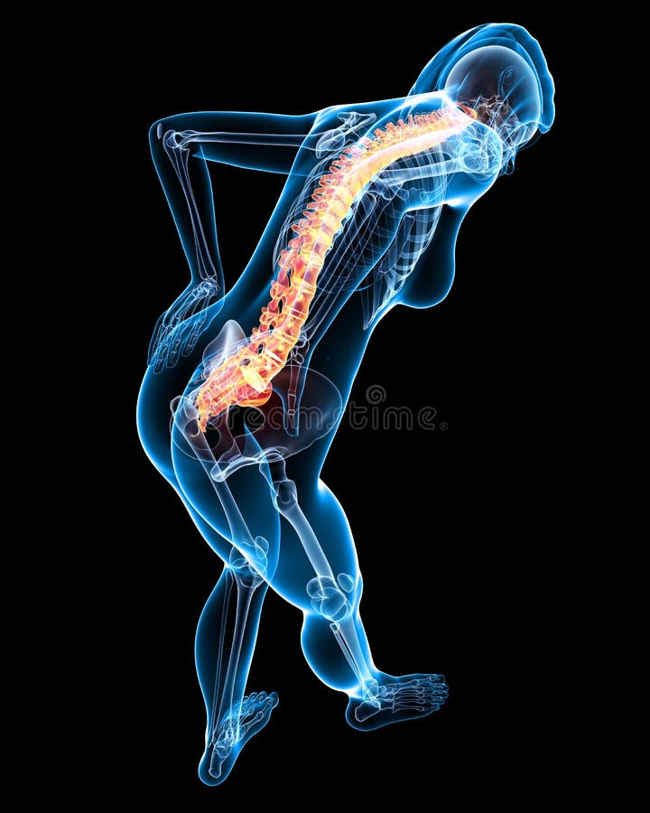 Back pain with full body stock illustration. Illustration of back