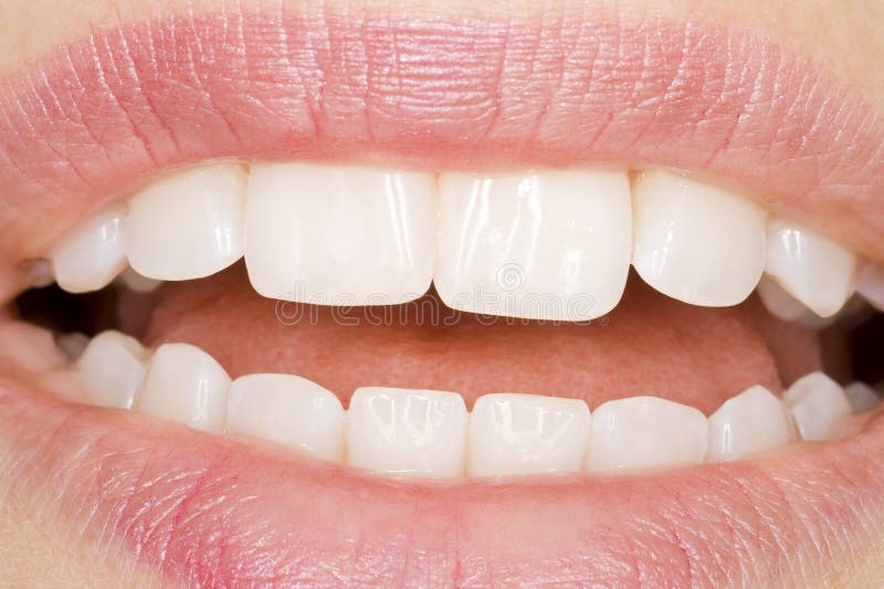 Beautiful teeth with perfect oral hygiene. Beautiful teeth with perfect oral hygiene