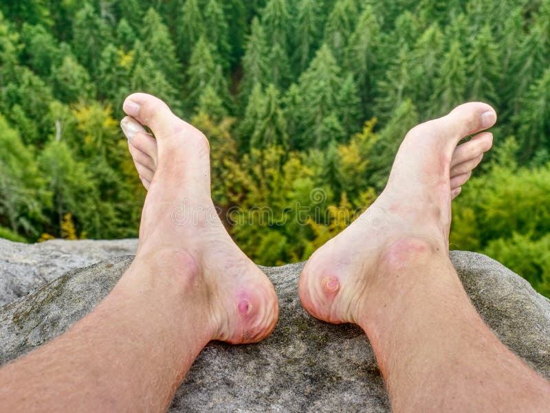 Hiker человека принимает потные ботинки на погоде утесов горы красивой стоковые фото Hiker человека принимает потные ботинки на погоде утесов горы красивой стоковые фото