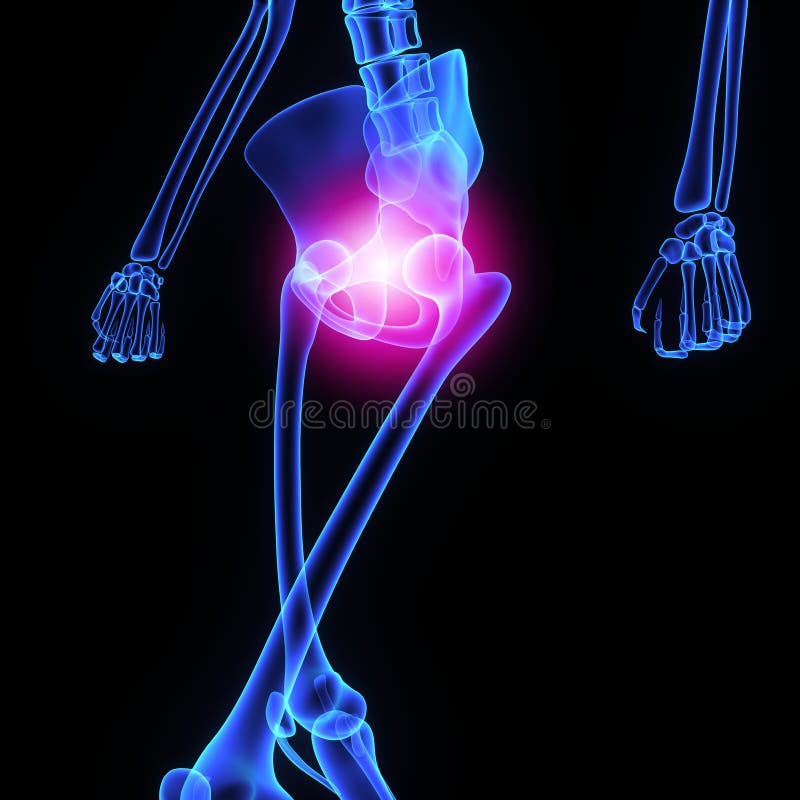 Hip joint stock illustration. Illustration of body, chiropractic 44733386
