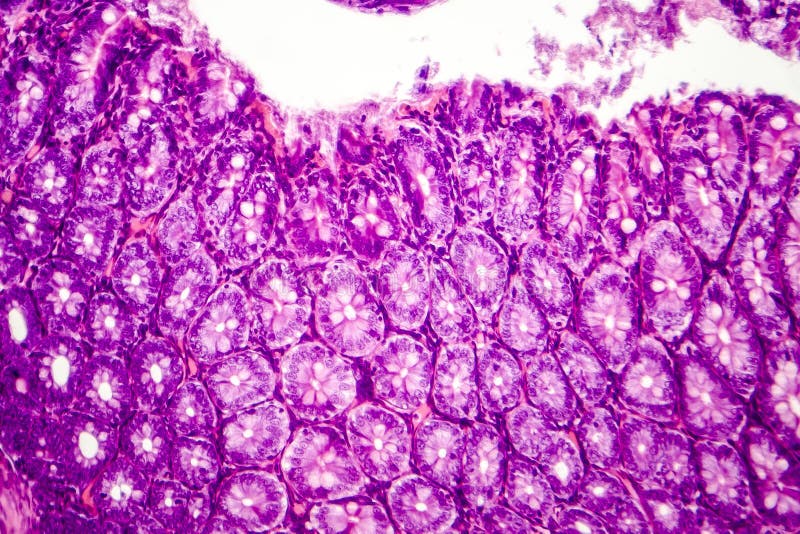Histologia ludzki apendyks, micrograph pokazuje Crypts Lieberkuhn zdjęcia stock Histologia ludzki apendyks, micrograph pokazuje Crypts Lieberkuhn zdjęcia stock