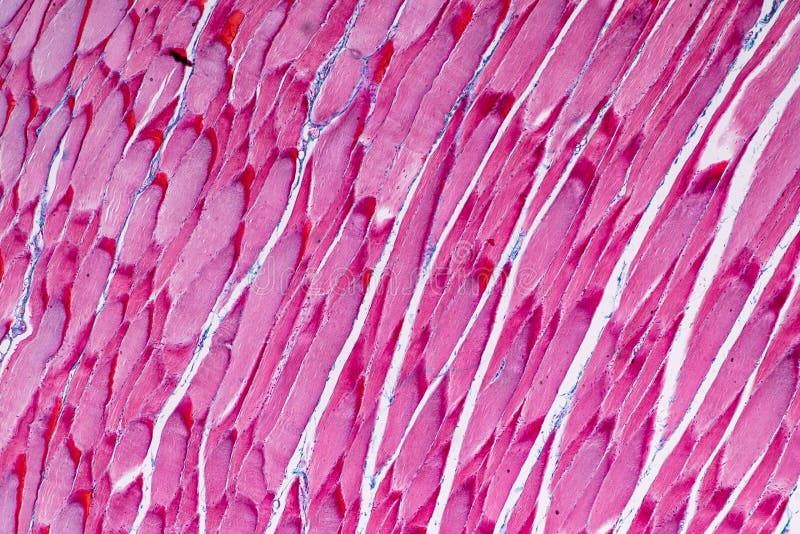 Гладкая мышечная ткань в дерме. Striated skeletal muscle Tissue. Мышцы под микроскопом. Скелетные мышцы под микроскопом. Мышечная ткань под микроскопом.