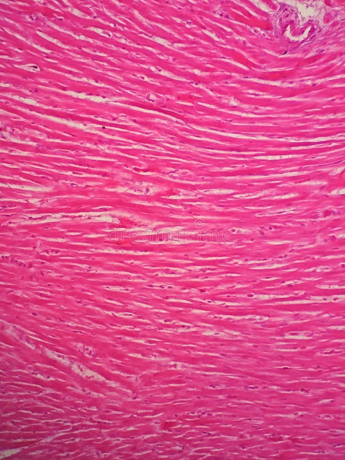 Cardiac Muscle Under Microscope 40x Labeled - Micropedia