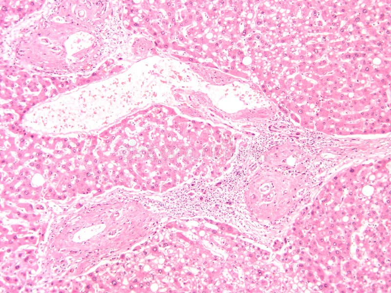 Histology of Human Liver Tissue Stock Photo Image of physiology, research 150577428