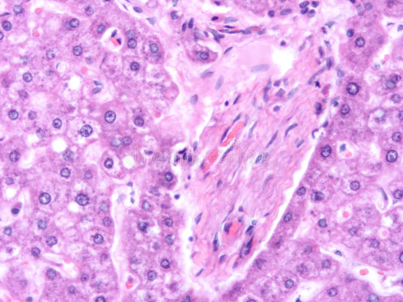 Histology of Human Liver Tissue Stock Photo Image of tissue, doctor 150577450