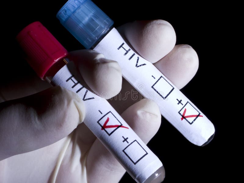 A hand holding test tubes with a label indicating HIV positive and negative test results. A hand holding test tubes with a label indicating HIV positive and negative test results.