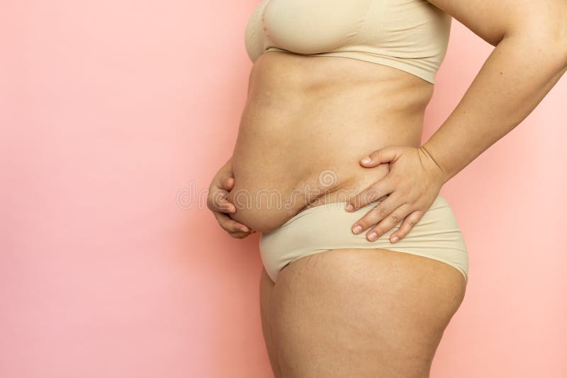 https://thumbs.dreamstime.com/b/hold-woman-sagging-belly-stand-sideways-closeup-folds-stomach-cellulite-obesity-naked-overweight-plus-size-hold-woman-245775545.jpg
