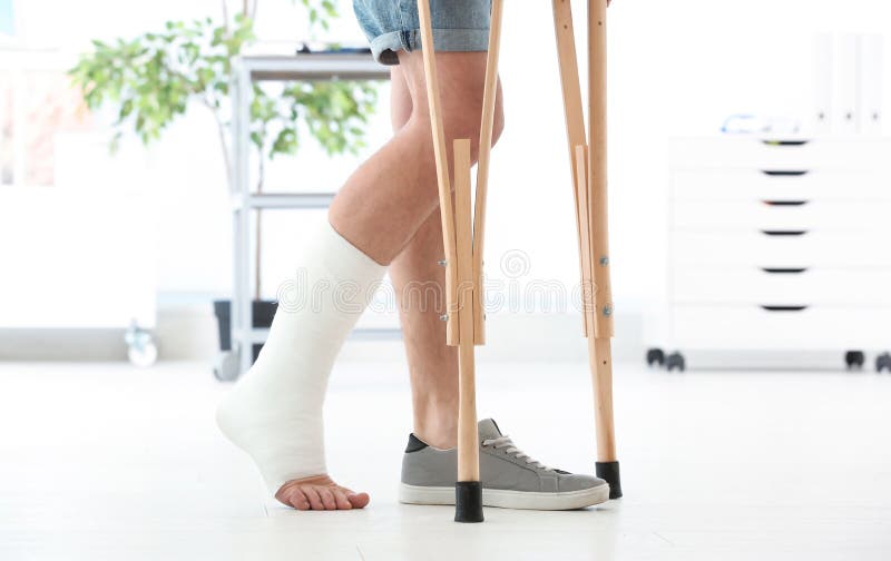 Homem com pé quebrado no molde que está em muletas fotografia de stock Homem com pé quebrado no molde que está em muletas fotografia de stock